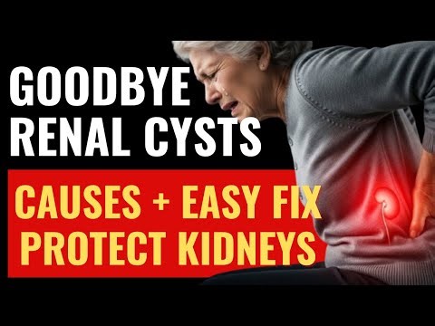 Goodbye Renal Cysts! Causes, Warning Signs & Easy Treatments Explained