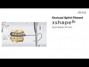 Consistent Fitment with 3D Printed Splints and 3Shape Splint Studio