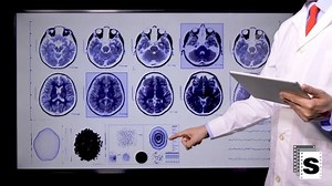 Doctor Analyzing Brain Scan on a Digital Display