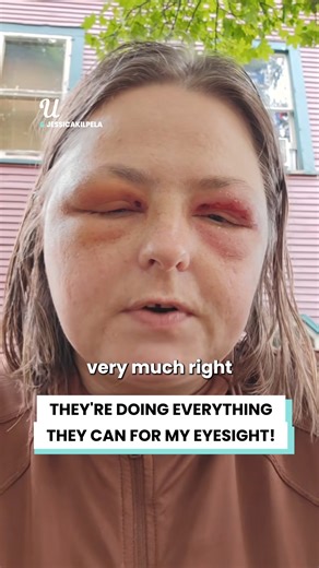 The emergency room turned me away 😳 | Ultimate