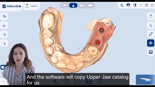Proficiently handling helps you to better enjoy the digital experience brought by helios500💎 #dentaltechnology #digitaldental #intraoralscanner #Eighteeth #dentallab #dentaltreatment #Helios500 | Eighteeth Medical