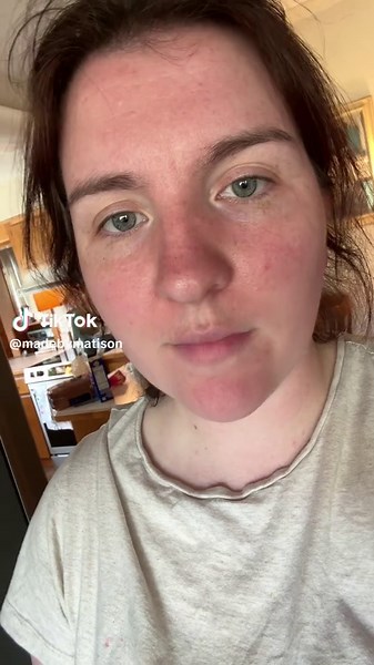 My freckles might be my favorite feature. Check out my 4 year olds drawing