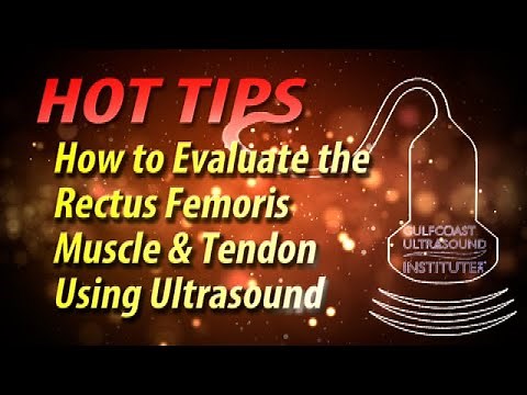 How to Evaluate the Rectus Femoris Muscle and Tendon Using Ultrasound