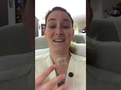 3 days post op c6-7 ACDF