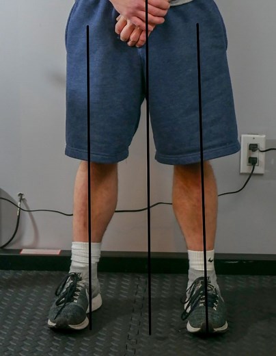 Feet, ankle, and knee muscle imbalances – Strong Links Fitness