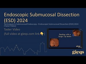 Techniques in Submucosal Endoscopy - Endoscopic Submucosal Dissection (ESD) 2024 (Taster Video)