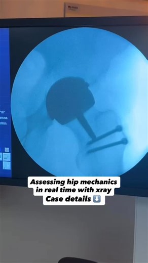 20K views · 52 reactions | Examination under anaesthetic for...