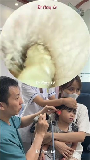 Pediatric Earwax Removal | Gentle & Safe Procedure #healthstories #humanbody