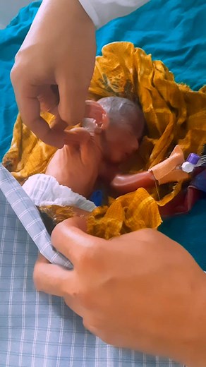 4M views · 16K reactions | Newborn baby care 樂 #BabyMilestone #JUNIOR #adorable #cutebaby #curious #cute #baby #babycare #trendingreels #viralreels #facebookreelsviral #FacebookReelsContest #facebookreels #reels #shorts | Global Nursing Profession | Facebook