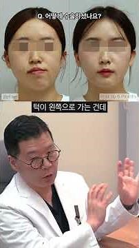 주걱턱과 안면 비대칭 양악수술 후기, "이렇게 수술 했습니다"