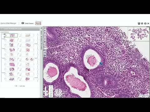 Endometrial Pathology for the Practicing Pathologist by Marisa Rose Nucci, M.D.