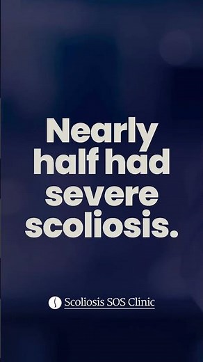 Our Experience Supporting 5,578 People With Scoliosis