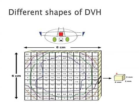 DVH; Dose Volume Histogram