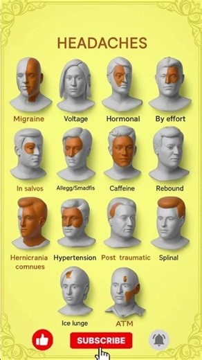 Types of Headaches | Causes, Symptoms & Relief Tips #headache