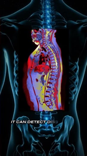 What a Full-Body MRI Actually Sees