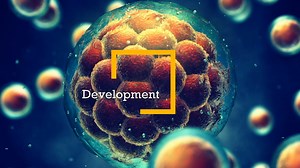 Development