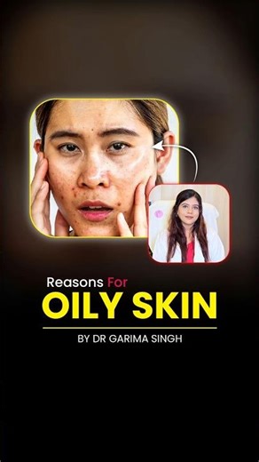 Oily Skin Ka Asli Reason Kya Hai? | Dermatologist