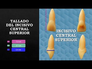 COMO TALLAR LA PIEZA 11 DE UNA MANERA FACIL