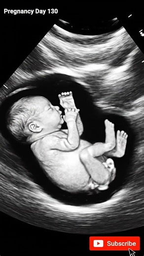 Pregnancy Week 18 (Day 130) | Ultrasound View 👶 #shorts #viralvideo