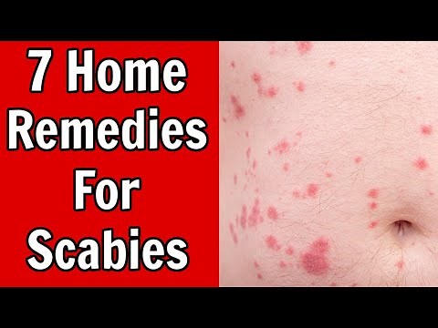 7 Home Remedies For Scabies