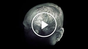 Mapping the Highways of the Brain