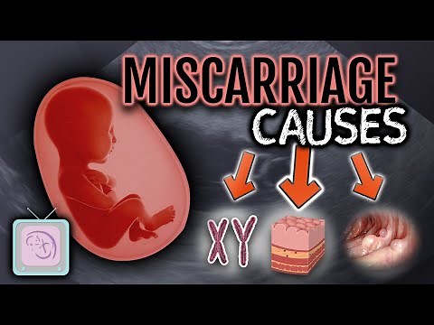 Dr. Morris' Ultimate Guide to Recurrent Miscarriage Testing
