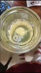 7K views | FOR THE FIRST TIME Such Clear Face Formation seen in EGG 讀...