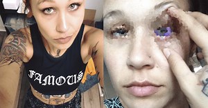 Facebook: modelo que se tatuó el ojo revela la terrible consecuencia de su acción [FOTOS]
