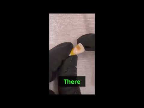 🤯 Central Tooth Nerve Size SHOCKER! You won't believe these measurements!