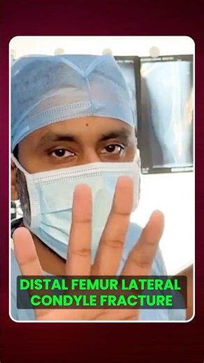 61 Years Female – Distal Femur Lateral Condyle Fracture #mippo #distalfemurfracture #kneeinjury
