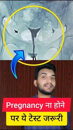 infertility test HSG