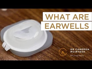The EarWell Infant Ear correction system