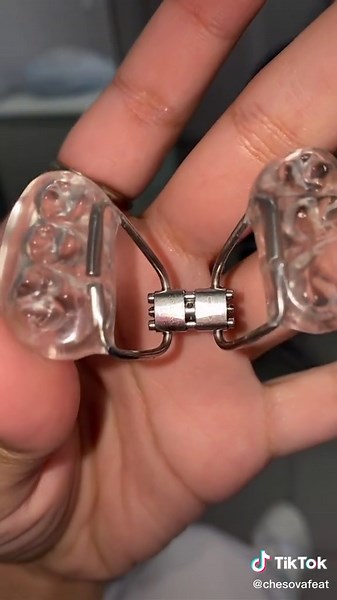 part 2: installing the orthodontic appliance! device