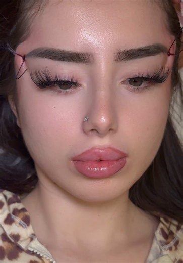 Achieve the Perfect Fox Eye Look with Thread Lifts