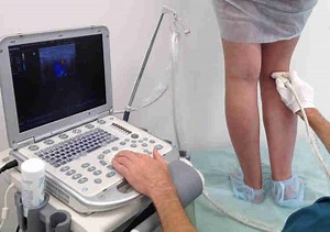 Am I a Candidate for a Leg Arterial Ultrasound?