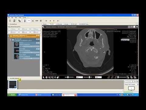 From dicom to jpg with Synedra