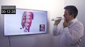 34K views · 532 reactions | The freedom of wireless intraoral scanning with the just-launched 3Shape TRIOS 3 Wireless | 3Shape | Facebook