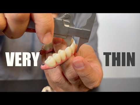 Explaining & Cementing a Very Thin, Strong & Hygenic Full-Mouth Implant Restoration