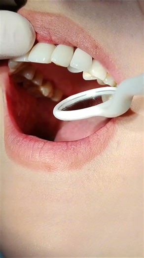 Real teeth vs. Fake teeth#DentalTips #Denture #FalseTooth #DentalRestoration