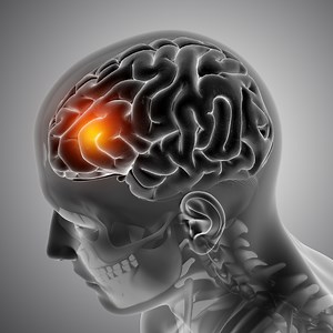 31K views · 413 shares | Five ways to cope with Aphasia, a condition that damages your cognitive functions and robs you of your language, speaking and reading abilities. | Doctor ASKY | Facebook