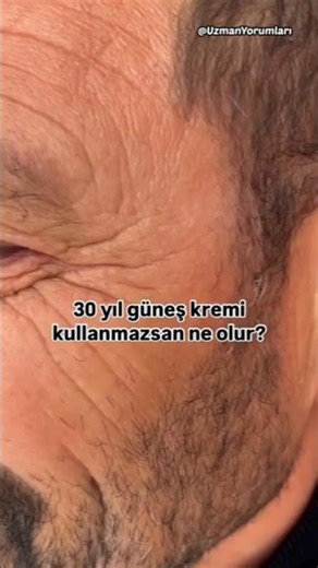 What happens if you don't use sunscreen for 30 years?🔆