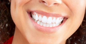 Aesthetic Dentistry - Dental Implant Center