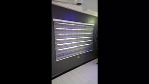 8.8K views · 45 reactions | So many questions about the zebra blinds so we decided to post a video on how it works. #curtainsolutionsGh #blinds 0201901788 | Curtain Solutions GH | Facebook