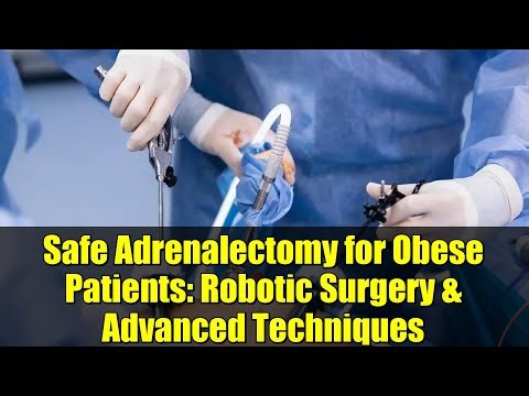 Safe Adrenalectomy for Obese Patients: Robotic Surgery & Advanced Techniques