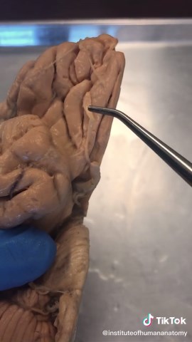 OLFACTORY SYSTEM!! Some even claim it could be more than 1 Trillion smells.. #suchascientist #neuroscience #biology #anatomy #scienceiscool