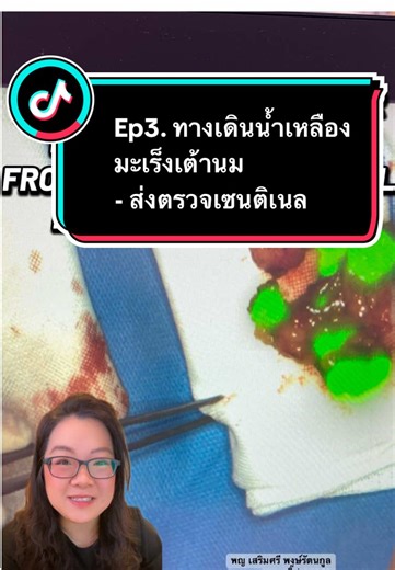 Ep3. ทางเดินน้ำเหลืองมะเร็งเต้านม-ต่อมน้ำเหลืองเซนทิเนล Sentinel Lymph node Biopsy #breastcancer #มะเร็งเต้านม #sentinel #หมอผ่าตัด #ก้อนเต้านม