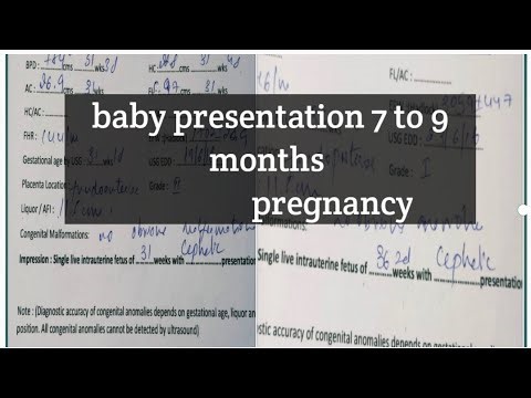 What is cephalic presentation? #viralvideo