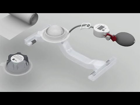 FemoStop Gold Deployment Video