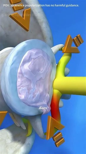 Spinal Decompression Therapy-3D Animation#spinaldecompression #spinaldecompressiontherapy