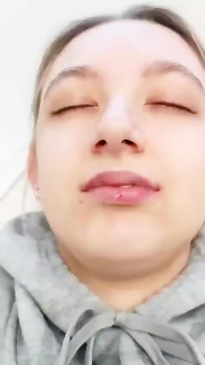 1K views | Before & After Lip Augmentation  Appointments available every Wednesday & Thursday in our Belfast clinic  #aestheticsclinic #lipaugmentation #lipfiller | Ava Training & Cosmetics | Facebook